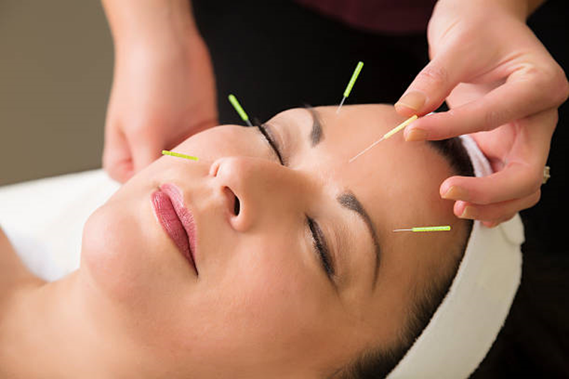 srvcosmeticacupuncture